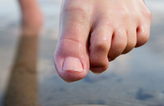 Wet feet encourage the spread of fungus. 